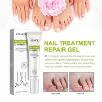 Natural Nail & Cuticle Fungal Care Gel