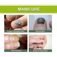 Natural Nail & Cuticle Fungal Care Gel