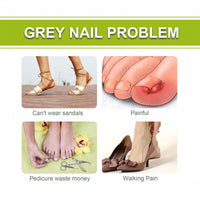 Natural Nail & Cuticle Fungal Care Gel