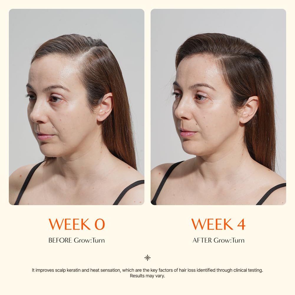 Growturn Hair Growth Serum