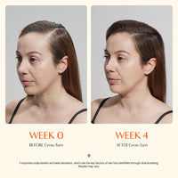 Growturn Hair Growth Serum