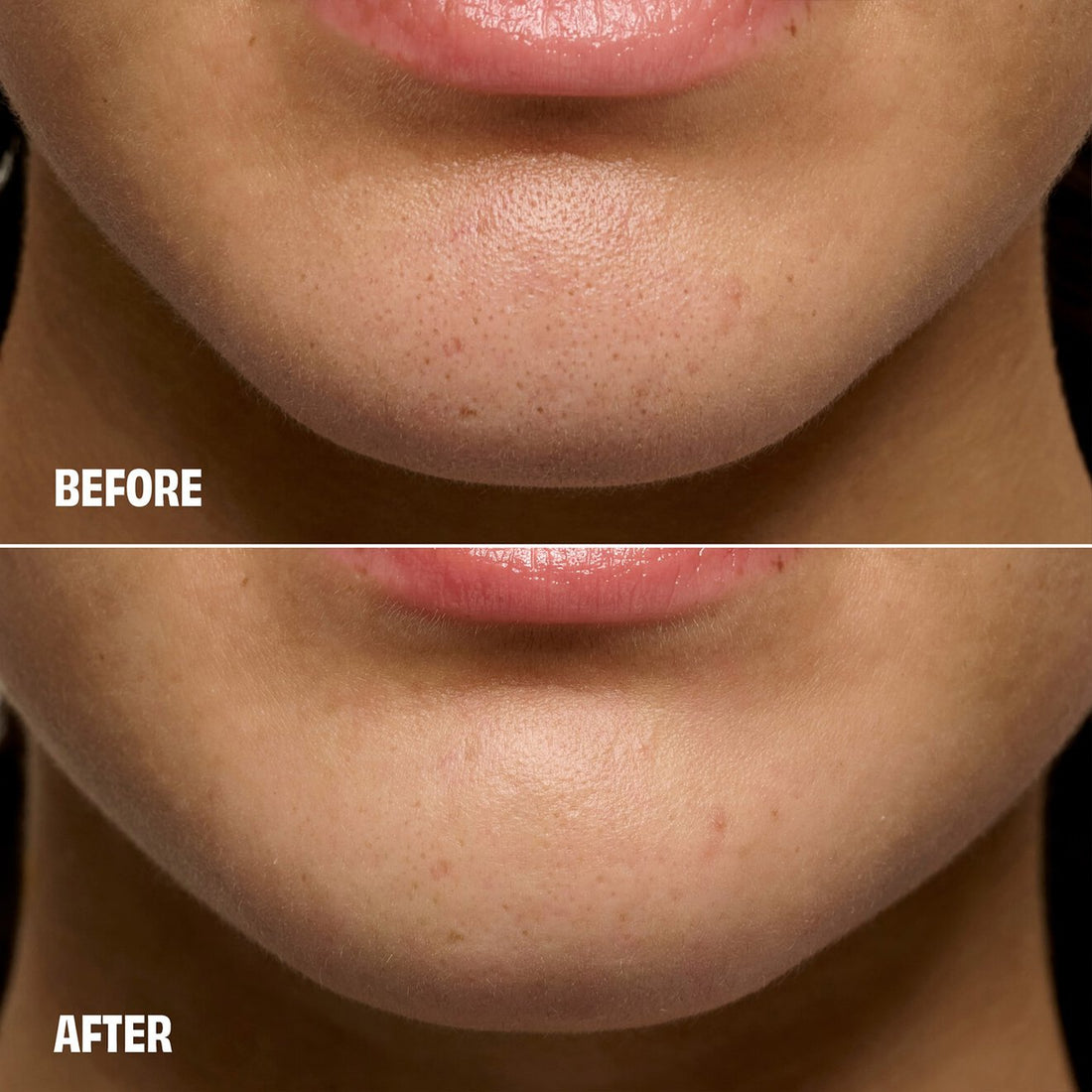 Blackhead Remover Primer