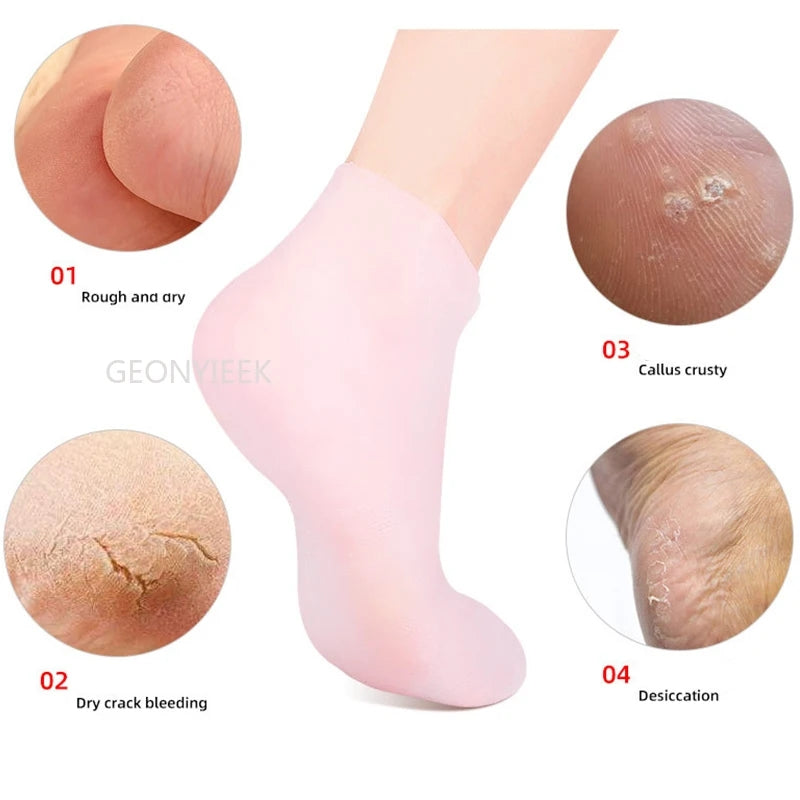 1 Pair Silicone Socks for Dry Cracked Feet