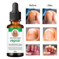 Natural Professional Nail Care Serum